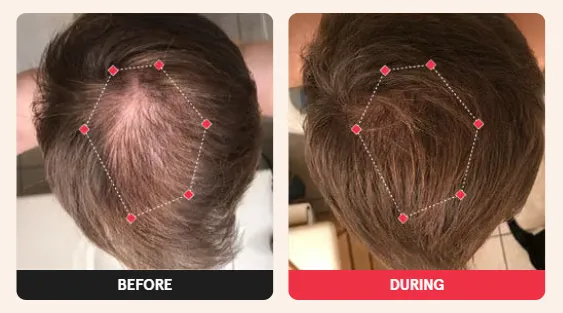 Before & After Results