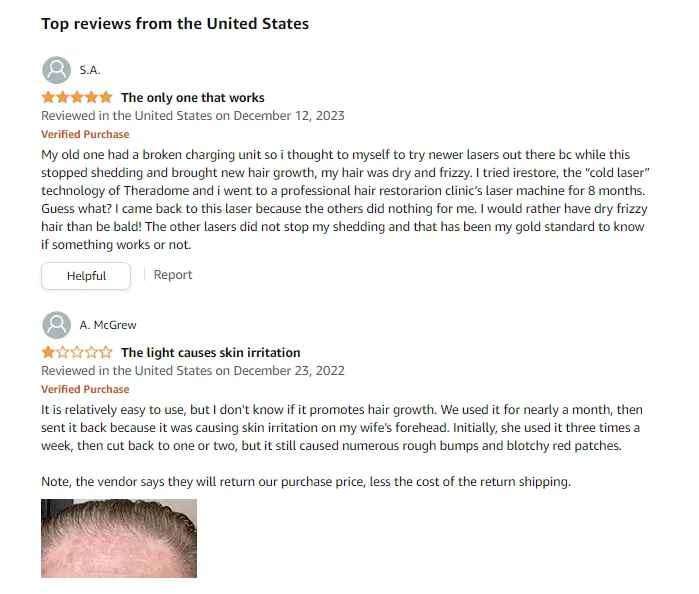 Amazon reviews