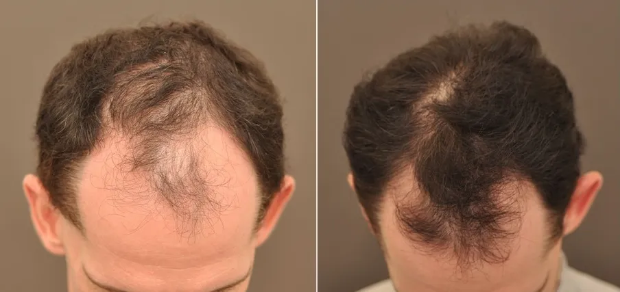 Before & After Results