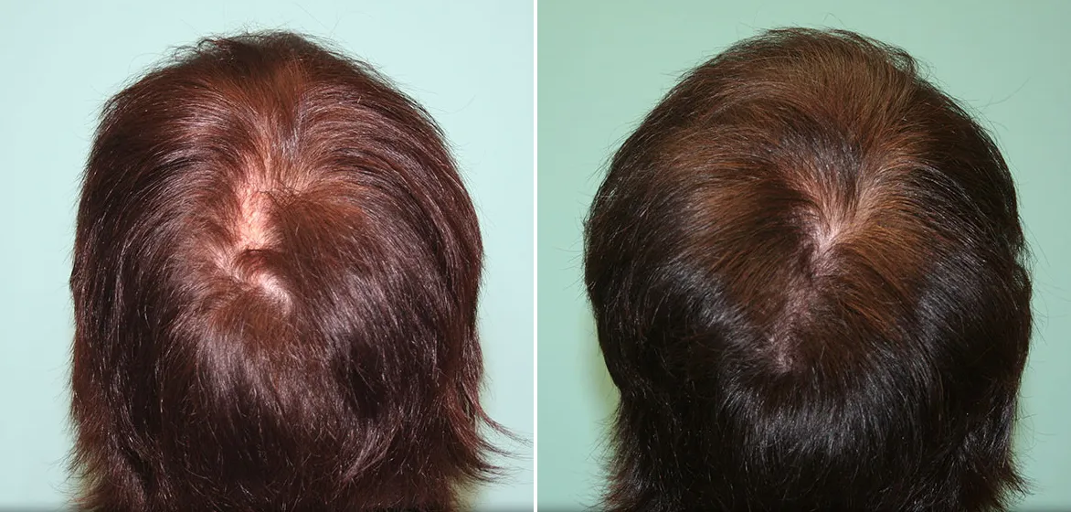 Before and After: iGrow Helmet Transformations