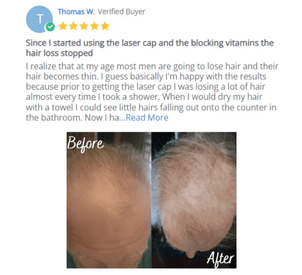 Kiierr 272 MD Elite customer review