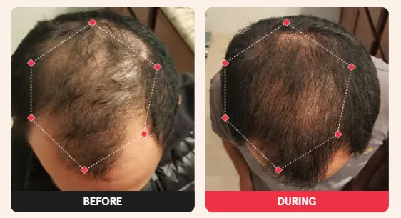 Before & After Results