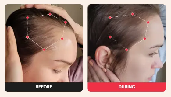 Before & After Results