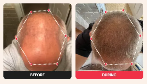 Before & After Results