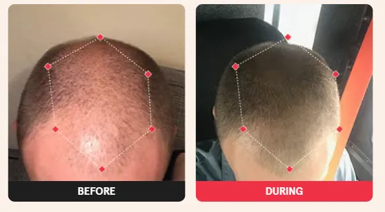 Before & After Results